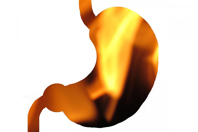 胃／十二指腸潰瘍のイメージ写真